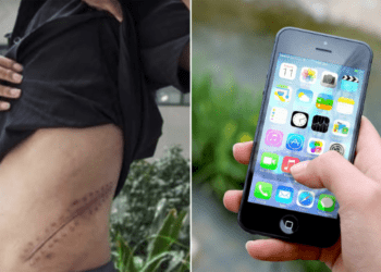 किडनी विकून महिलेने घेतला आयफोन, आता झालीये अशी अवस्था!